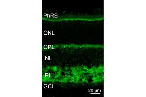 Indirect immunostaining of a PFA fixed mouse retina section (dilution 1 : 5000). (SCAMP1 antibody  (AA 2-15))