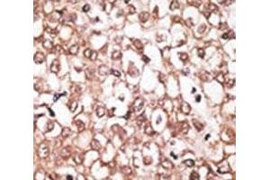 Immunohistochemistry (IHC) image for anti-ATP-Binding Cassette, Sub-Family B (MDR/TAP), Member 11 (ABCB11) (AA 1038-1067) antibody (ABIN3030049)