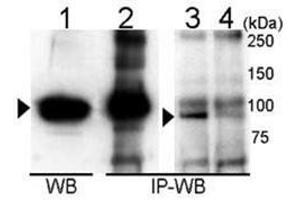Immunoprecipitation and Western blot analysis of anti-UVRAG Antibody  in 293T cells.