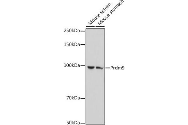 PRDM9 antibody