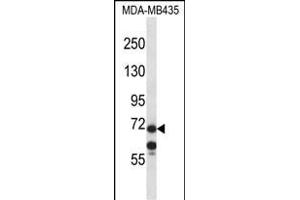 MID1 Antibody (C-term) (ABIN657388 and ABIN2846429) western blot analysis in MDA-M cell line lysates (35 μg/lane). (MID1 antibody  (C-Term))