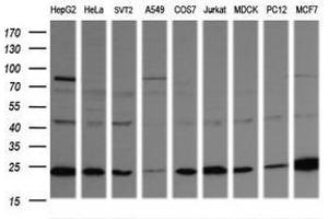 Image no. 5 for anti-RAB21, Member RAS Oncogene Family (RAB21) antibody (ABIN1500542) (RAB21 antibody)