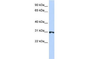 WB Suggested Anti-RNF126 Antibody Titration:  0. (RNF126 antibody  (N-Term))