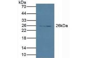 Detection of PRSS2 in Porcine Pancreas lysate using Polyclonal Antibody to Protease, Serine 2 (PRSS2) (PRSS2 antibody  (AA 24-241))