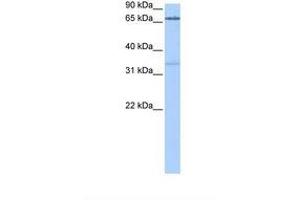 Image no. 1 for anti-Peptidyl Arginine Deiminase, Type II (PADI2) (AA 344-393) antibody (ABIN6738820) (PADI2 antibody  (AA 344-393))