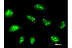 Immunofluorescence of purified MaxPab antibody to NOL14 on HeLa cell.