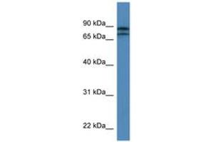 Image no. 1 for anti-Kelch-Like 22 (KLHL22) (AA 175-224) antibody (ABIN6746879) (KLHL22 antibody  (AA 175-224))