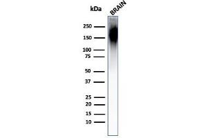 Western Blot Analysis of Human Brain Tissue Lysate using Neurofilament Mouse Monoclonal Antibody (NF421). (NEFH antibody)