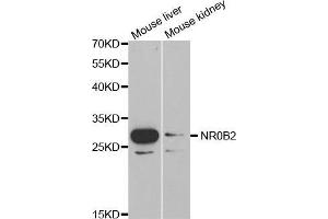 Western blot analysis of extracts of various cell lines, using NR0B2 antibody.