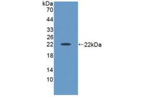 Western blot analysis of recombinant Human ACVA. (ACVA antibody  (AA 44-178))