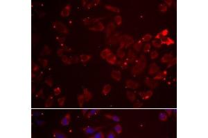 Immunofluorescence analysis of A549 cells using GATM Polyclonal Antibody (GATM antibody)