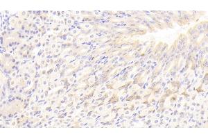 Detection of LIPC in Mouse Stomach Tissue using Polyclonal Antibody to Lipase, Hepatic (LIPC) (LIPC antibody  (AA 159-415))