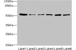 Western blot All lanes: ZNF398 antibody at 3 μg/mL Lane 1: 293T whole cell lysate Lane 2: Hela whole cell lysate Lane 3: HepG2 whole cell lysate Lane 4: Jurkat whole cell lysate Lane 5: Caco-2 whole cell lysate Lane 6: A549 whole cell lysate Secondary Goat polyclonal to rabbit IgG at 1/10000 dilution Predicted band size: 72, 53 kDa Observed band size: 53 kDa (ZNF398 antibody  (AA 401-642))