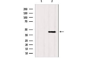 Western blot analysis of extracts from rat heart, using ACADS antibody.