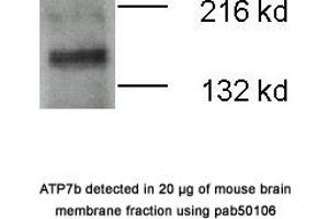 Image no. 1 for anti-ATPase, Cu++ Transporting, beta Polypeptide (ATP7B) (N-Term) antibody (ABIN363415) (ATP7B antibody  (N-Term))