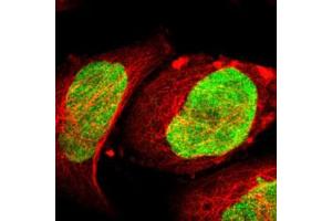 Immunofluorescent staining of A-431 cells with ILKAP polyclonal antibody  (Green) shows positivity in nucleus.