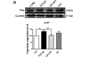 Slug is regulated by the co-transcriptional complex YAP1/TEAD in the EMT program of A549 cells. (GAPDH antibody)