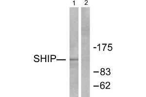 Western blot analysis of extracts from Jurkat cells, treated with PMA (1ng/ml, 15mins), using SHIP antibody (ABIN5976503).