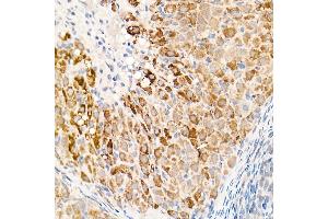 Immunohistochemistry of paraffin-embedded rat ovary using OGDH Rabbit pAb (ABIN6131414, ABIN6145003, ABIN6145005 and ABIN6222018) at dilution of 1:25 (40x lens). (alpha KGDHC antibody  (AA 148-427))