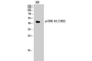 Western Blotting (WB) image for anti-Mitogen-Activated Protein Kinase 1/3 (MAPK1/3) (pThr202) antibody (ABIN3172890) (ERK1/2 antibody  (pThr202))