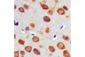 Immunohistochemical analysis of NOTCH1 staining in human brain formalin fixed paraffin embedded tissue section. (Notch1 antibody  (Center))