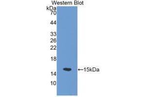 Western blot analysis of the recombinant protein. (SLC30A5 antibody  (AA 639-751))