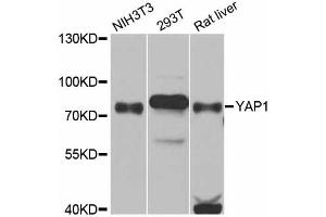 Western blot analysis of extracts of various cell lines, using YAP1 antibody (ABIN5974703) at 1/1000 dilution. (YAP1 antibody)