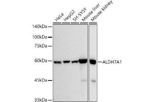 Western blot analysis of extracts of various cell lines, using  antibody (ABIN7265544) at 1:500 dilution. (ALDH7A1 antibody)