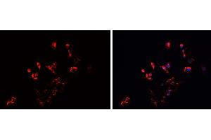ABIN6279542 staining HEPG2 cells by IF/ICC. (IMMP2L antibody  (Internal Region))