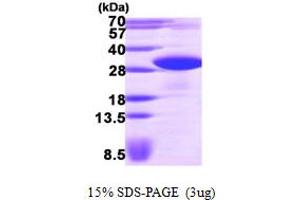 SDS-PAGE (SDS) image for VAMP (Vesicle-Associated Membrane Protein)-Associated Protein B and C (VAPB) (AA 1-222) protein (His tag) (ABIN667277) (VAPB Protein (AA 1-222) (His tag))