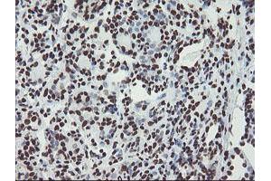 Immunohistochemical staining of paraffin-embedded Human breast tissue using anti-NONO mouse monoclonal antibody. (NONO antibody  (AA 184-385))