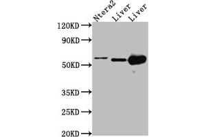 Western Blot Positive WB detected in: Ntera-2 whole cell lysate, Mouse Liver whole cell lysate, Rat Liver cell lysate All lanes: ALDH2 antibody at 1:1000 Secondary Goat polyclonal to rabbit IgG at 1/50000 dilution Predicted band size: 57, 51 kDa Observed band size: 57 kDa (Recombinant ALDH2 antibody)