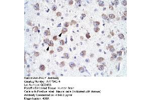 Human Brain (Raly antibody  (N-Term))