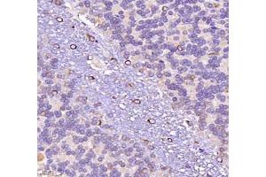 Immunohistochemistry of paraffin embedded rat epencephalon using NRG2 (ABIN7074804) at dilution of 1: 500 (400x lens)