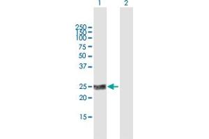 Western Blot analysis of KLK2 expression in transfected 293T cell line by KLK2 MaxPab polyclonal antibody. (Kallikrein 2 antibody  (AA 1-223))