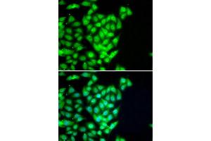 Immunofluorescence analysis of U20S cell using RAD51B antibody. (RAD51 Homolog B antibody)
