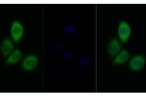 Detection of INSR in Human MCF7 cell using Polyclonal Antibody to Insulin Receptor (INSR) (Insulin Receptor antibody  (AA 1101-1372))