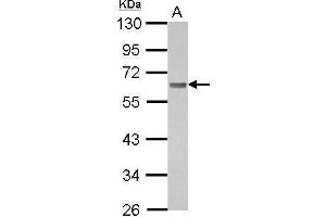 WB Image Sample (30 ug of whole cell lysate) A: A431 10% SDS PAGE antibody diluted at 1:1000 (BIN1 antibody)
