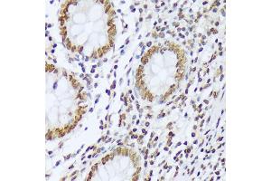 Immunohistochemistry of paraffin-embedded human appendix using Phospho-c-Abl-Y412 antibody (ABIN7265966) at dilution of 1:100 (40x lens). (ABL1 antibody  (pTyr412))