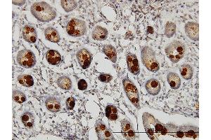 Immunostaining (ISt) image for anti-Abhydrolase Domain Containing 5 (ABHD5) (AA 1-349) antibody (ABIN565526)