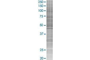 Western Blotting (WB) image for PIK3R1 293T Cell Transient Overexpression Lysate(Denatured) (ABIN1332974)