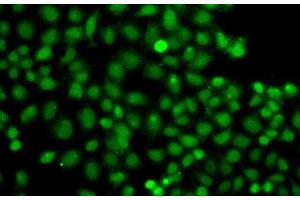 Immunofluorescence analysis of A549 cells using PIP5K1A Polyclonal Antibody (PIP5K1A antibody)