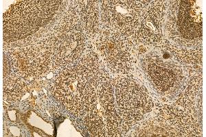 ABIN6264546 and ABIN6272948 at 1/100 staining Rat ovary tissue by IHC-P. (QSOX1 antibody  (Internal Region))