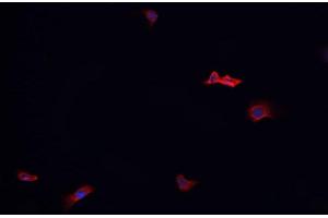 ABIN6268970 staining HeLa? (Dematin antibody  (pSer403))