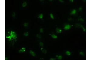 Immunofluorescence (IF) image for anti-alpha-Fetoprotein (AFP) (AA 19-397) antibody (ABIN2716008) (alpha Fetoprotein antibody  (AA 19-397))