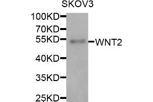 Western blot analysis of extracts of SKOV3 cells, using WNT2 antibody.