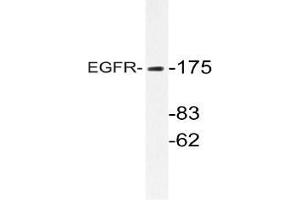 Western blot (WB) analyzes of EGFR antibody in extracts from HepG2 cells. (EGFR antibody)
