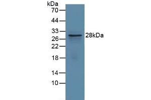 Detection of Recombinant GCLM, Human using Polyclonal Antibody to Glutamate Cysteine Ligase, Modifier Subunit (GCLM) (GCLM antibody  (AA 40-251))