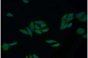 Detection of CYCS in Human MCF7 cell using Polyclonal Antibody to Cytochrome C (CYCS) (Cytochrome C antibody  (AA 5-100))