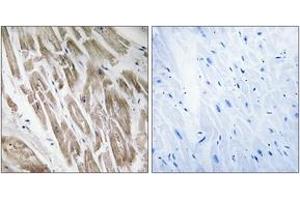 Immunohistochemistry analysis of paraffin-embedded human heart, using NDUFS5 Antibody. (NDUFS5 antibody  (AA 57-106))